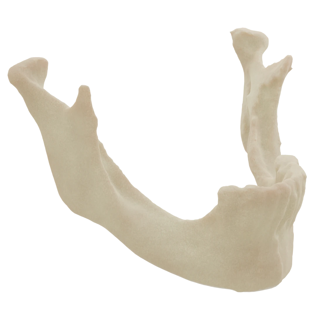 Mandible with Partial edentulousness